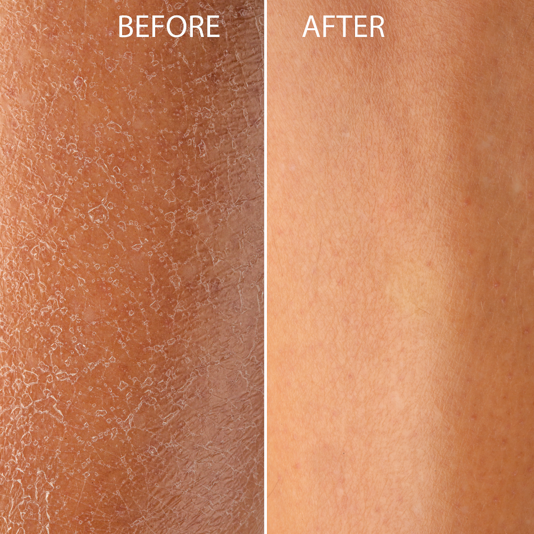 Cellular Renewal Methylene Blue Body Lotion